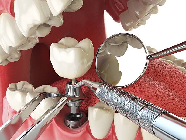 Best After-Hours Dental Care in Kelly Ridge, CA