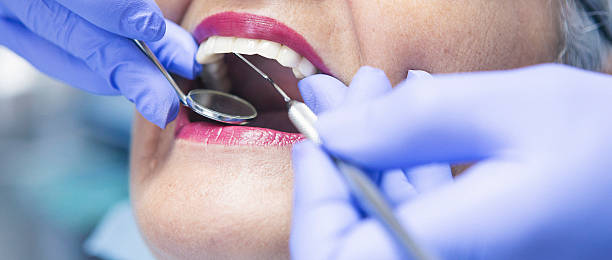 Best Broken or Chipped Tooth Repair in Kelly Ridge, CA