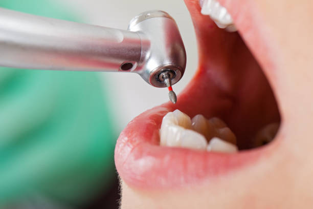 Best 24-Hour Emergency Dental Care in Kelly Ridge, CA
